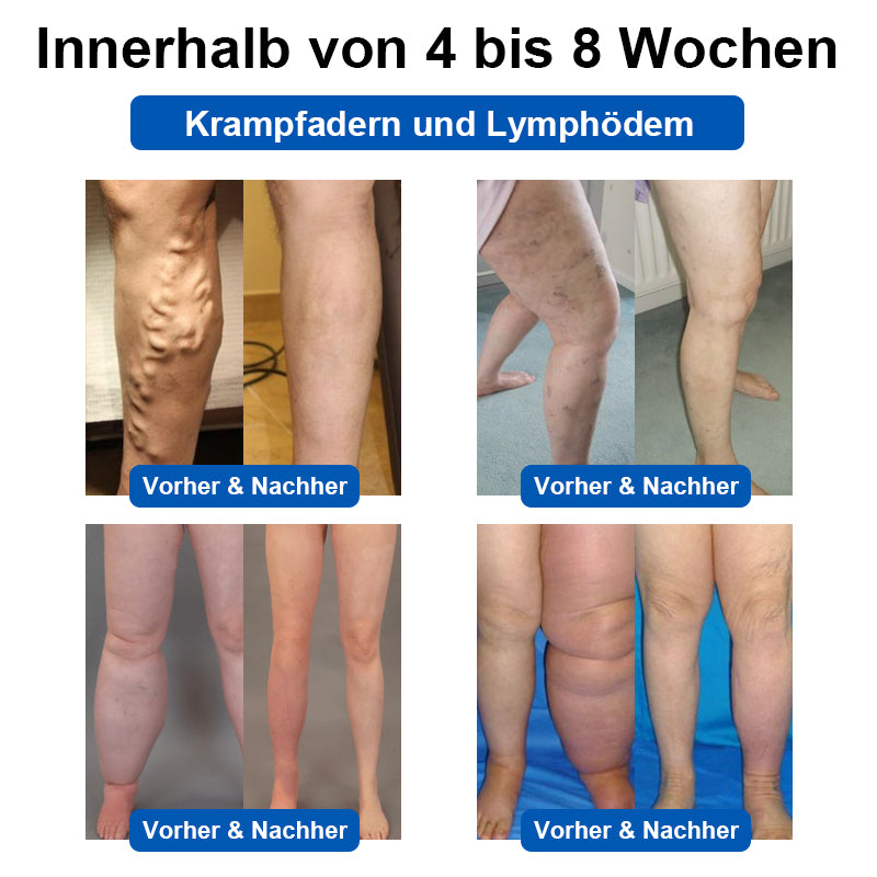 ✅TÜV-zertifiziert | 🌟GFOUK™ Ultraschall-Fettverbrennungs- und Entgiftungsarmband (🔥LETZTER TAG 70% RABATT)