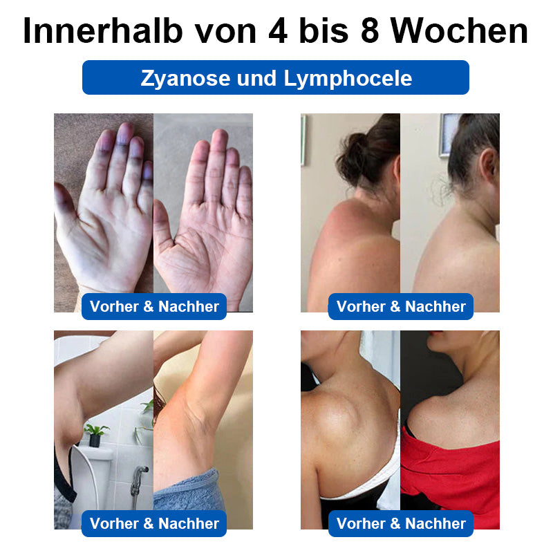 ✅TÜV-zertifiziert | 🌟GFOUK™ Ultraschall-Fettverbrennungs- und Entgiftungsarmband (🔥LETZTER TAG 70% RABATT)