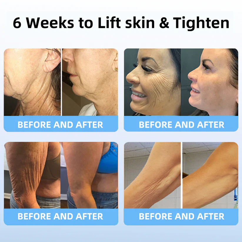 flysmus™ SkinLift Anti-Falten Creme: Stellt die Hautelastizität wieder her 💃 LETZTER TAG 70% RABATT🔥