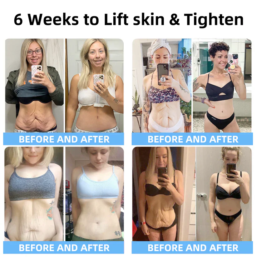 flysmus™ SkinLift Anti-Falten Creme: Stellt die Hautelastizität wieder her 💃 LETZTER TAG 70% RABATT🔥