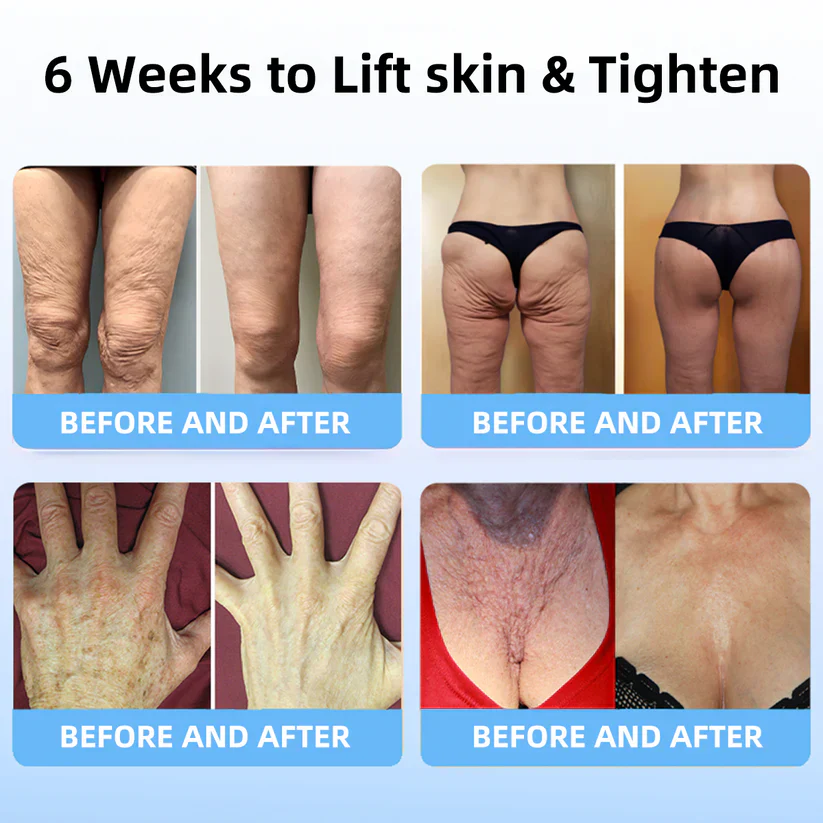 flysmus™ SkinLift Anti-Falten Creme: Stellt die Hautelastizität wieder her 💃 LETZTER TAG 70% RABATT🔥